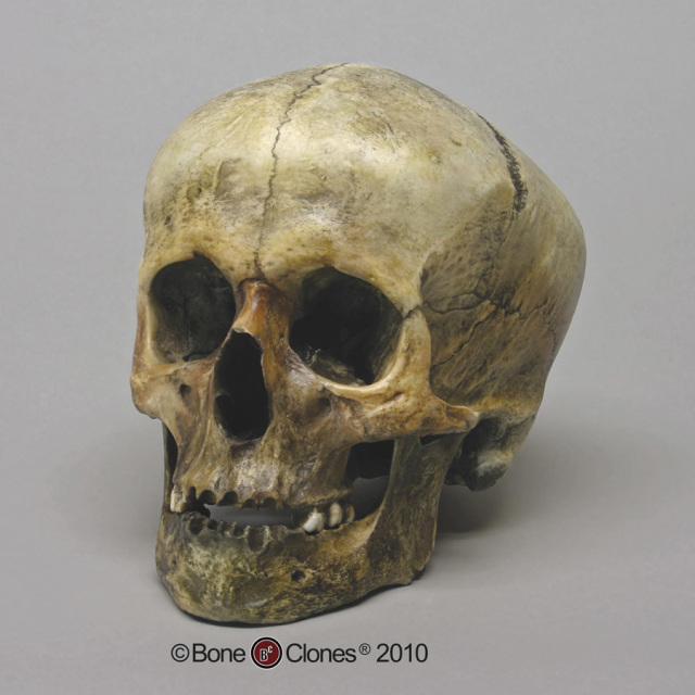 human skull discolored clone s521972503441136676_p925_i1_w640.jpeg
