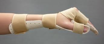 Splint-1