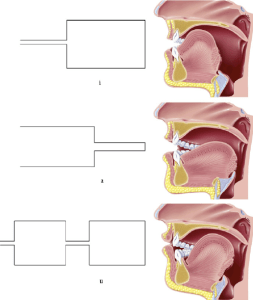 fig-4-schematic-representation-of-three-vowels-i-a-u-with-two-or-four-tubes-original