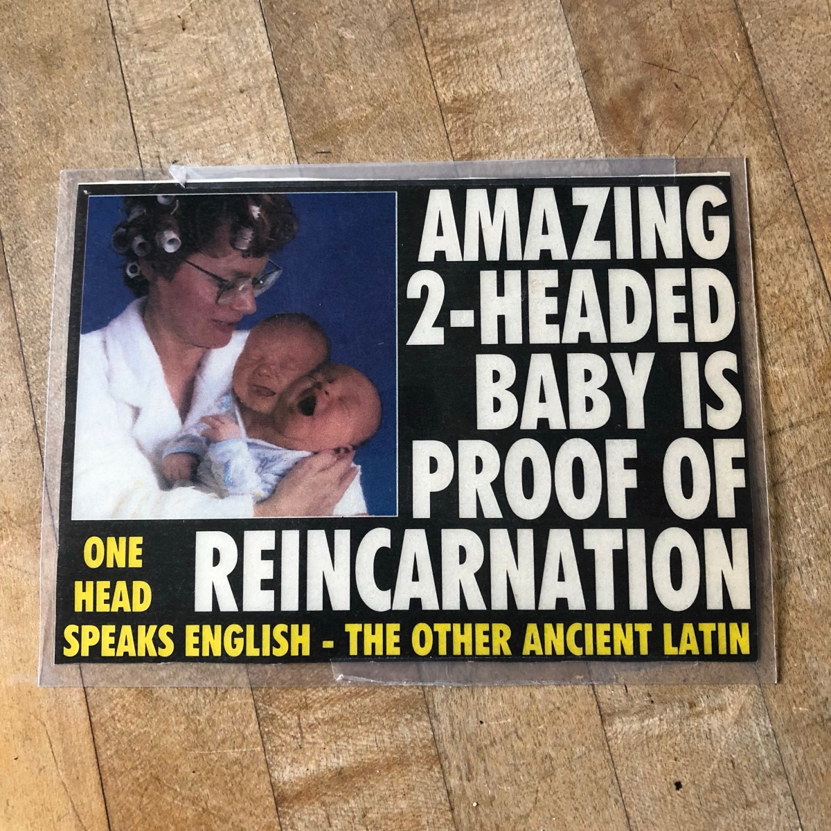 Amazing two-headed baby