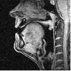 How to irritate a linguist, Part 5: English irregular past-tense verb&nbsp;practice