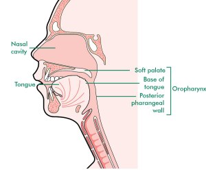 MACD014_head-neck-oropharynx_20150427_large_tcm9-282898